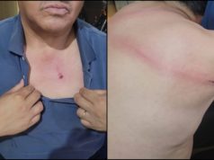 A cadenazos, un vendedor ambulante hirió a un inspector municipal en pleno centro