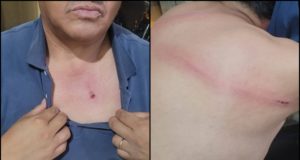 A cadenazos, un vendedor ambulante hirió a un inspector municipal en pleno centro