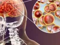 Preocupación por la meningitis: aumentaron los casos y advierten sobre la baja vacunación