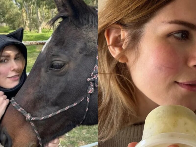Lilia Lemoine anunció que se aleja de los medios tras sufrir un accidente por «montar a pelo»: qué le pasó